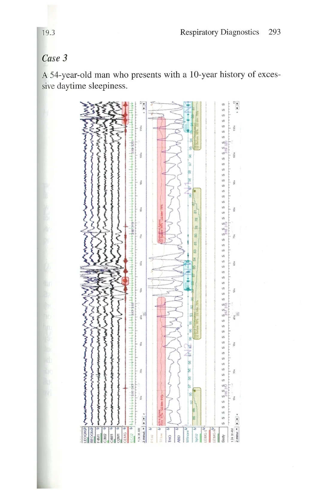 Original page 25